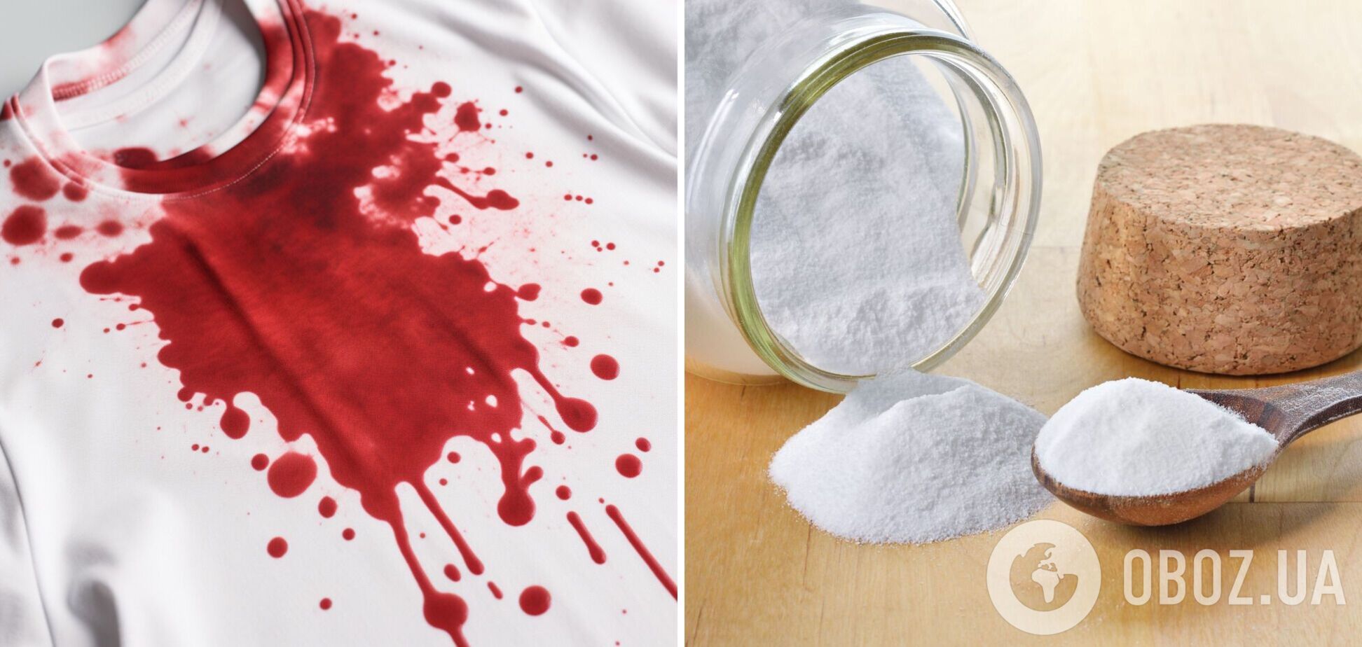Как вывести с одежды пятна крови: поможет кухонный продукт