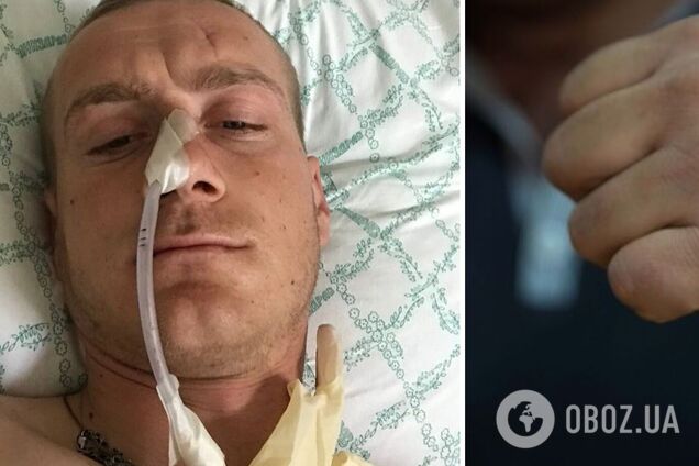 На Львівщині розгорівся скандал через побиття військового на полігоні: за справу взялося ДБР. Фото