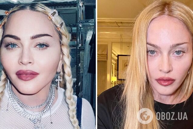 Мадонна вперше вийшла на зв‘язок після госпіталізації та показала, як її змінила хвороба. Фото