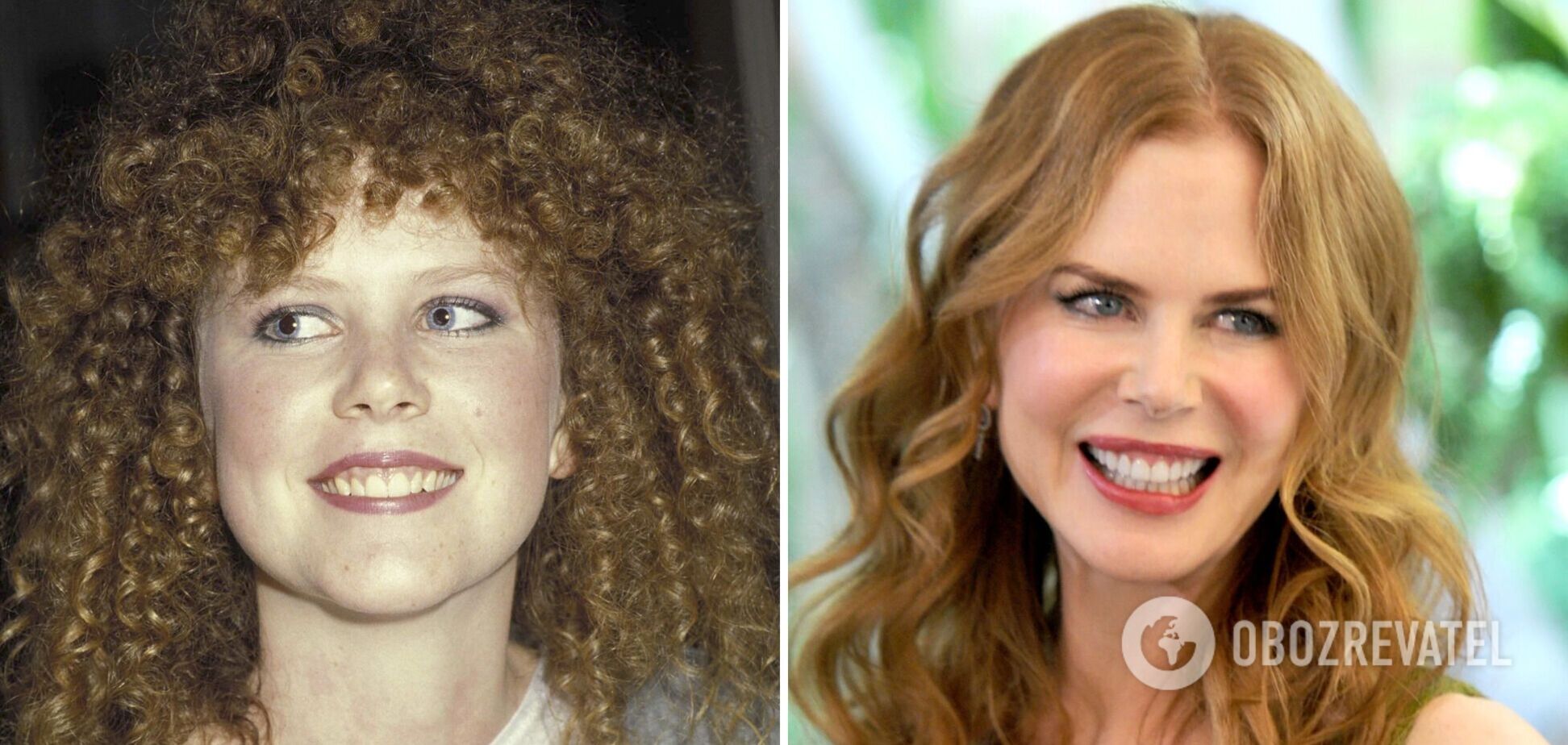 Приховали дефекти усмішки: 5 зіркових красунь, які поставили штучні зуби. Фото до і після реставрації