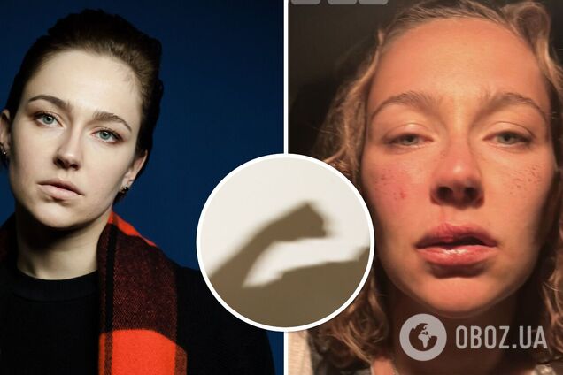 Відома російська ведуча в день народження отримала по обличчю від українця, з яким жила: пара часто сварилася через політику