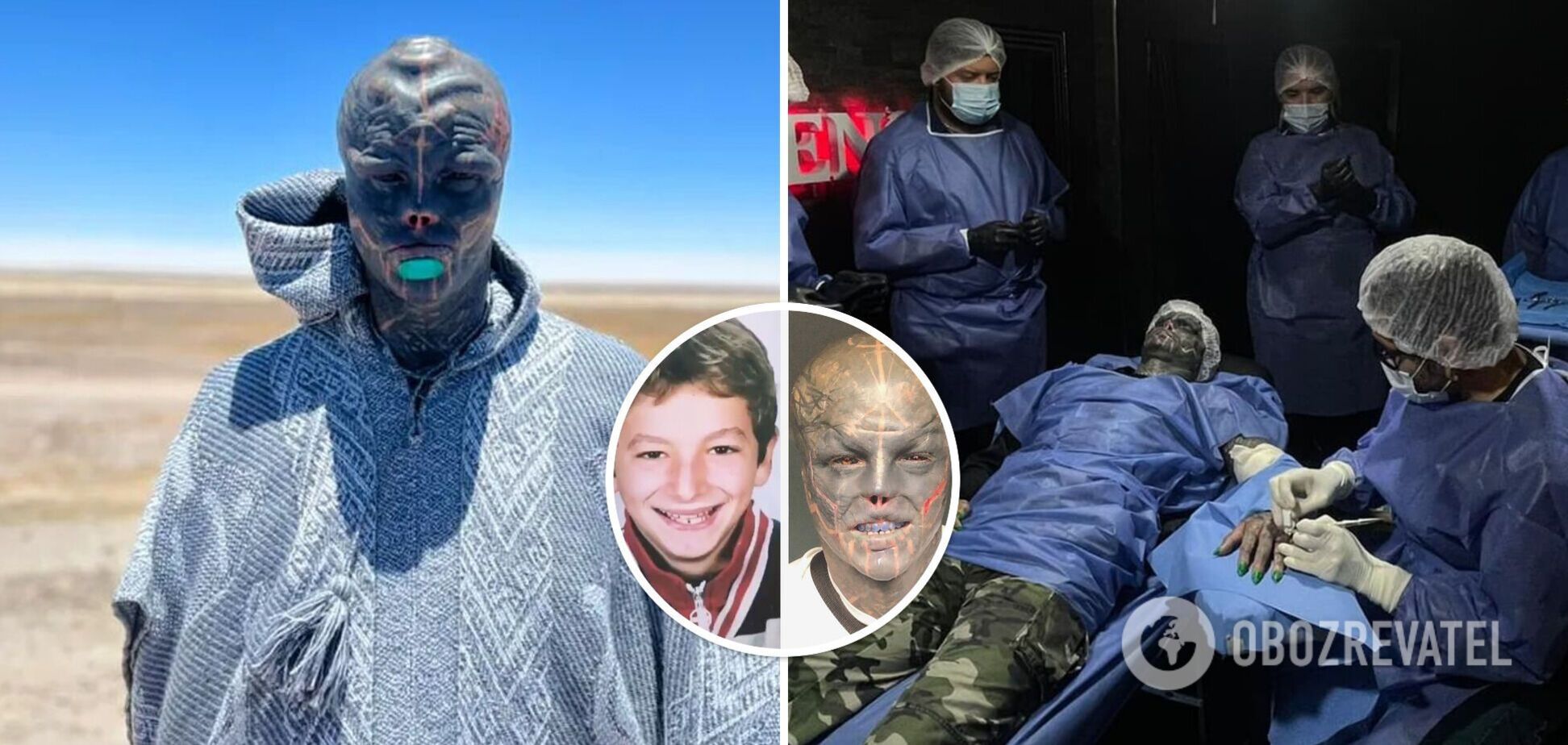 'Чорний Прибулець' без вух та носа показав, яким був у 13 років до численних операцій і татуювань. Фото вражають
