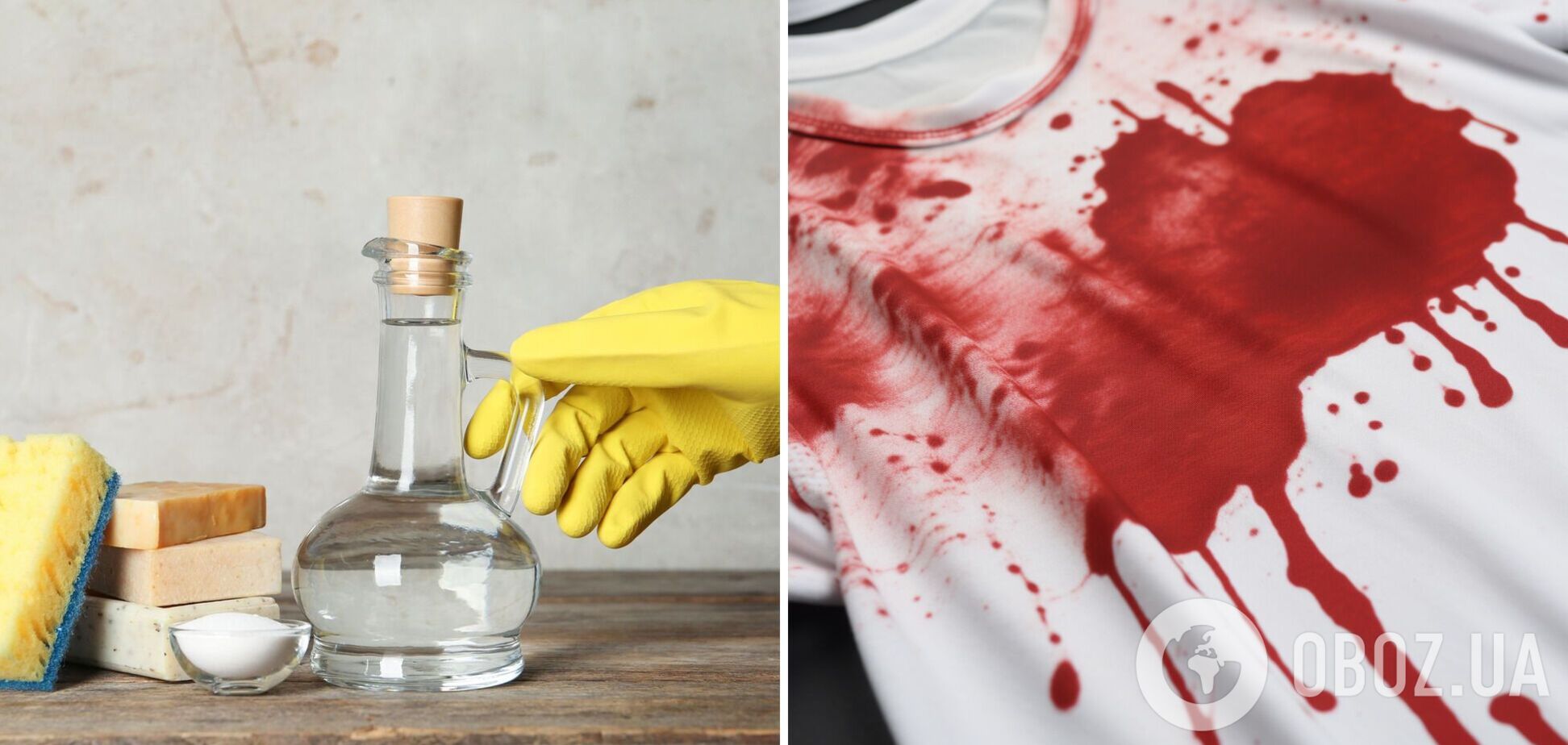 Як швидко позбутися плям крові на одязі: перевірений метод