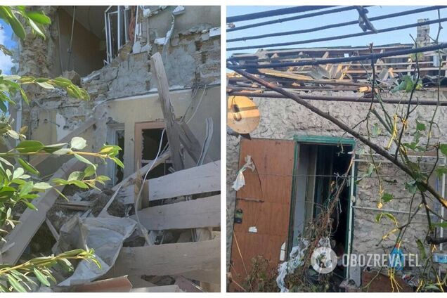 В Херсонской области из-за российских обстрелов снова пострадали мирные жители: фото