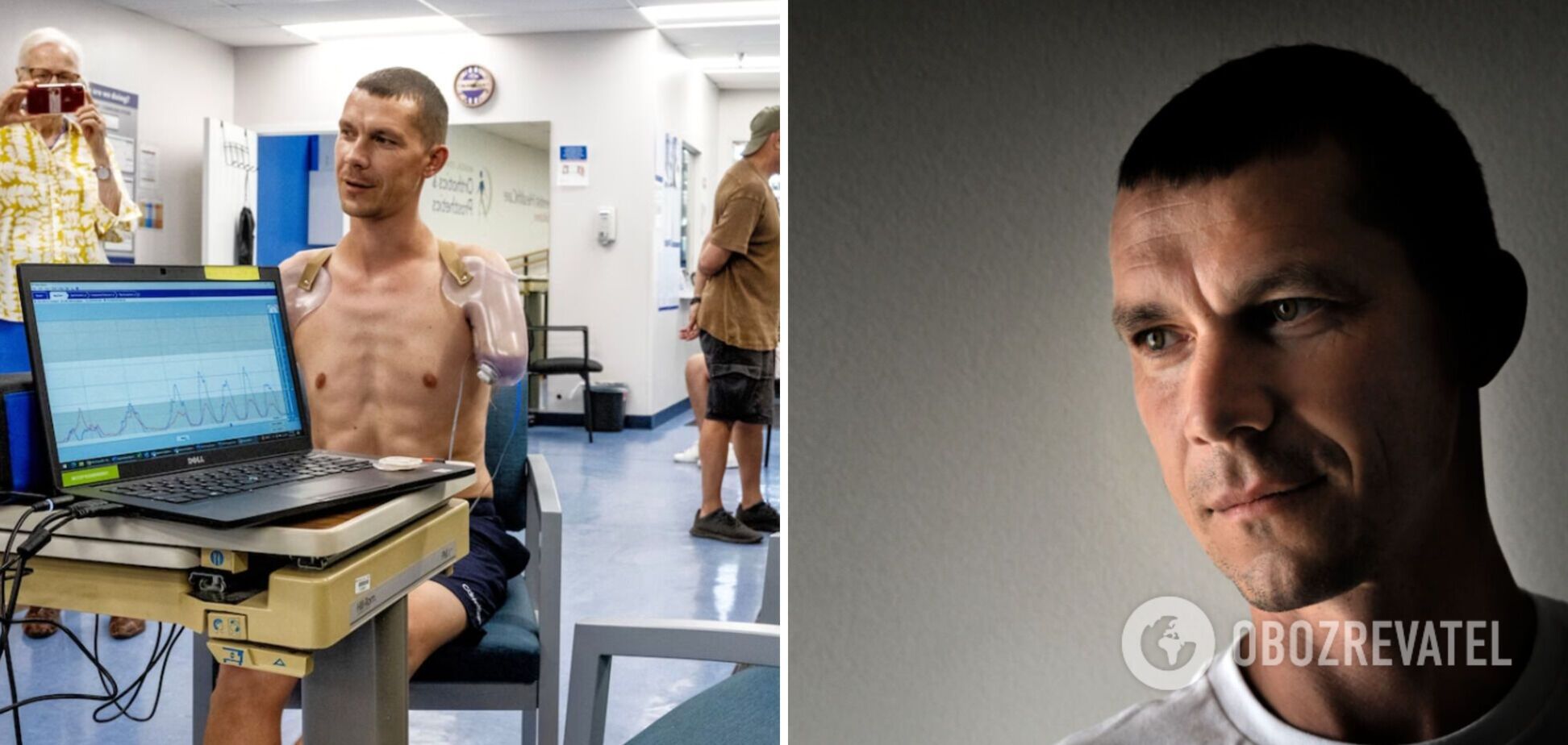 Украинскому военному в плену в ЧВК 'Вагнер' ампутировали раненые руки без наложения швов – The Washington Post