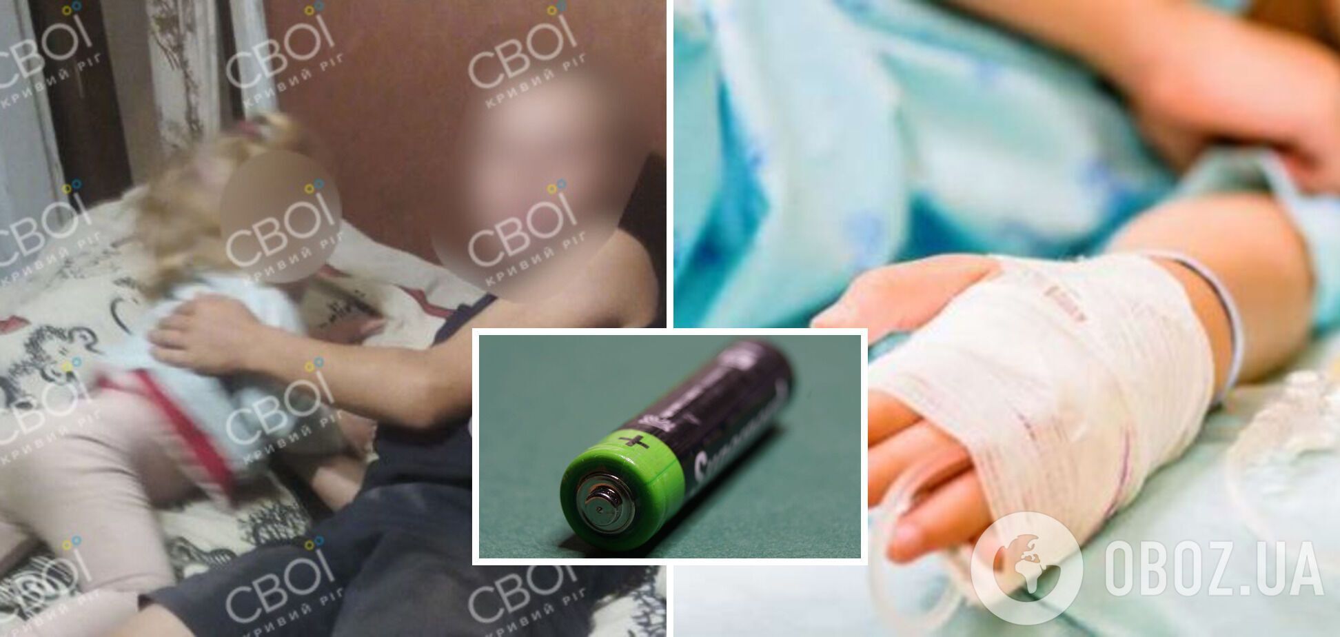 У Кривому Розі в 11-річного хлопчика у руках вибухнула батарейка: дитина отримала серйозні травми – ЗМІ