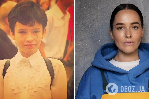 Обзивали тарганом: Астафʼєва розповіла про складний перебіг хвороби, яку так і не змогли визначити