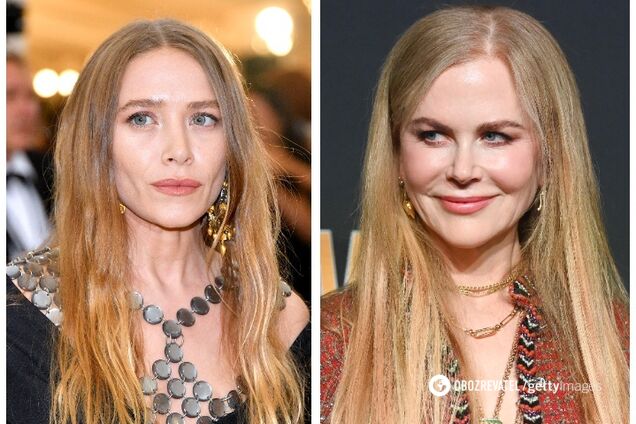 Как сейчас выглядят Кидман, Зеллвегер и другие звезды, сделавшие подтяжку лица 10 лет назад