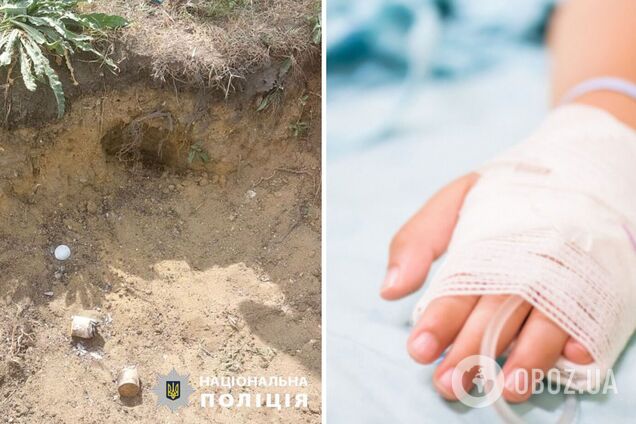 Из-за пиротехники в Одесской области пострадали дети