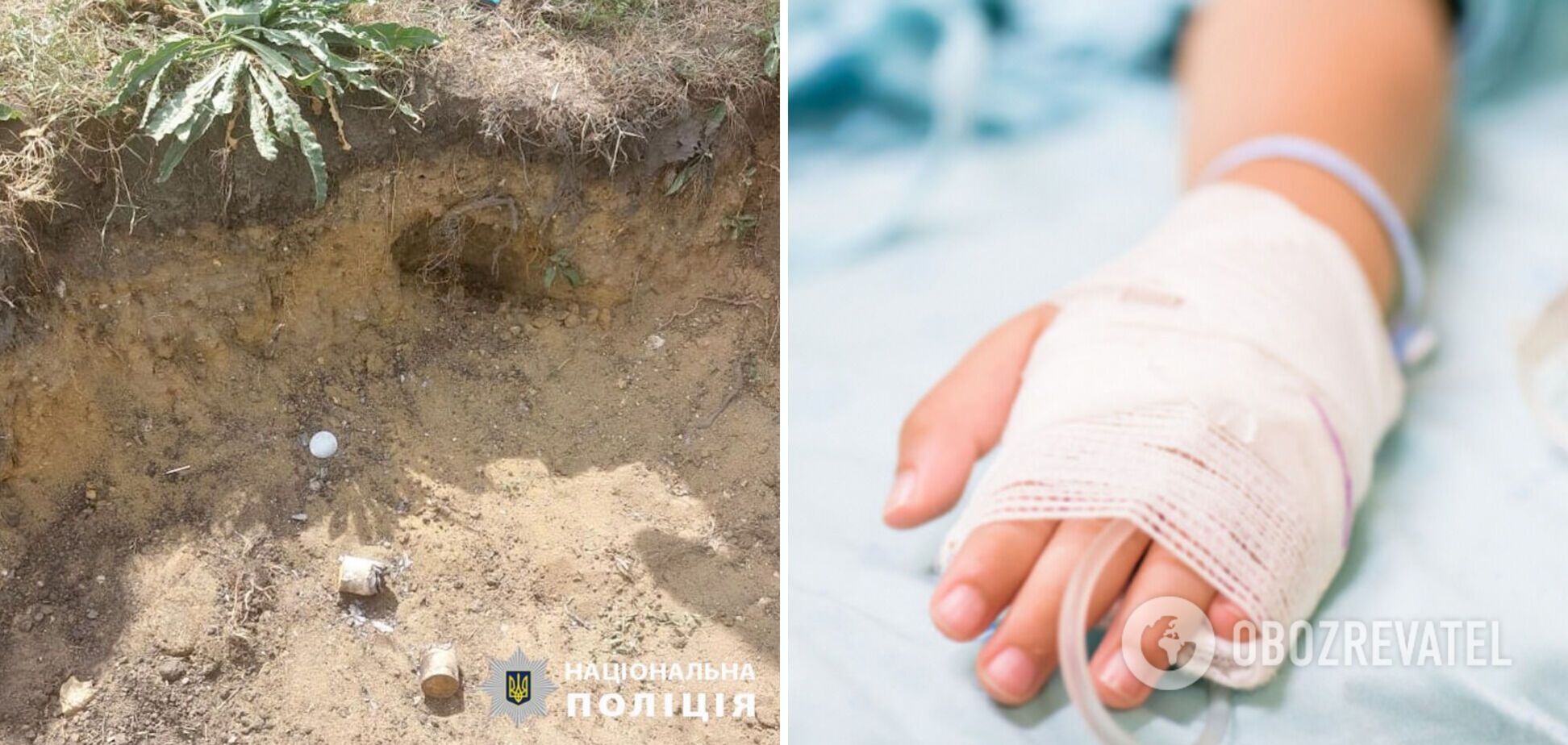 Через піротехніку на Одещині постраждали діти