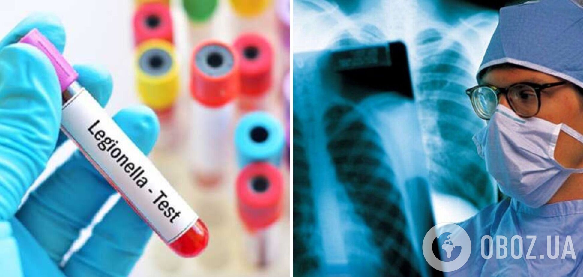 В польском Жешуве восьмой человек умер в результате 'болезни легионеров': что известно о вспышке и как распознать симптомы