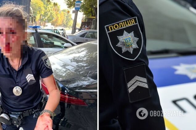 Переломаны нос и кости лица: появились данные о состоянии патрульной, которую избил водитель Jaguar в Днепре