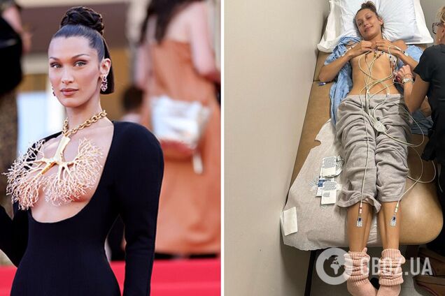Супермодель Белла Хадид рассказала о тяжелой болезни, с которой боролась 15 лет, показав пугающие фото из больницы