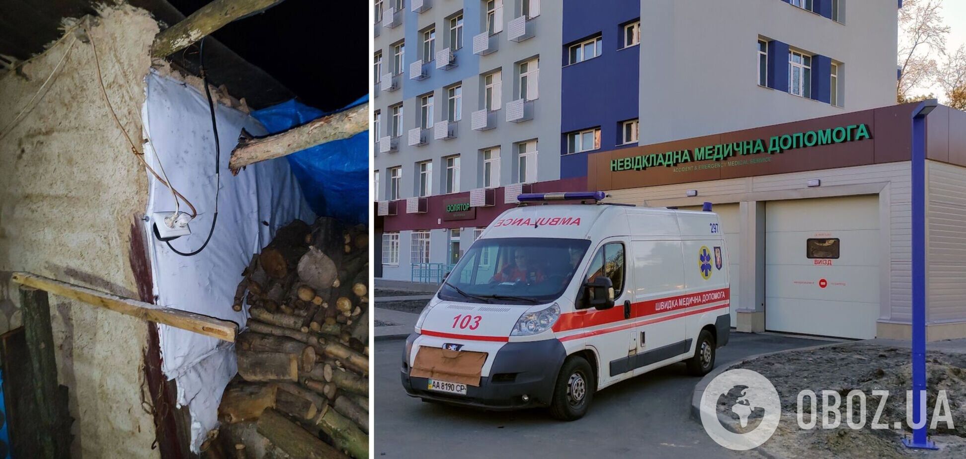 Ребенка с ожогом руки госпитализировали