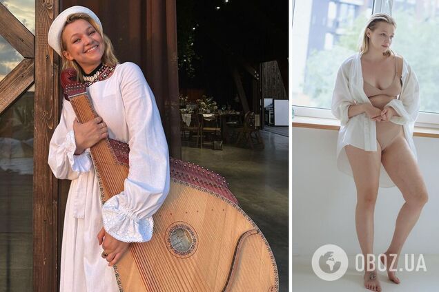 'Вилила на себе добрячу порцію окропу': співачка KRUTЬ уперше показала пошрамоване тіло та шокувала фанів своєю історією