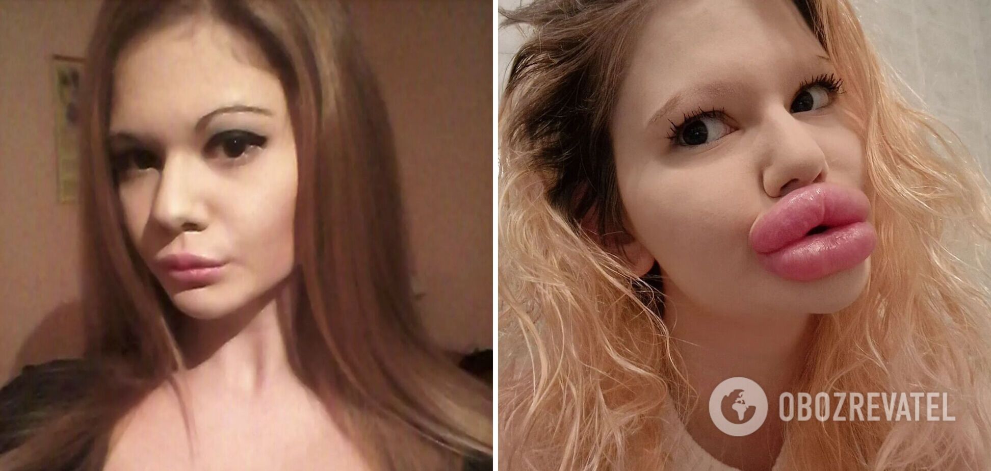 Как выглядит болгарка Андреа Иванова с самыми большими в мире губами и почему ее боятся мужчины. Фото