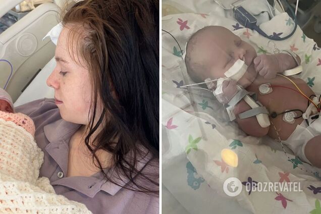 19-летняя девушка не знала о своей беременности, пока из нее не вылезла... ножка ребенка. Невероятная история