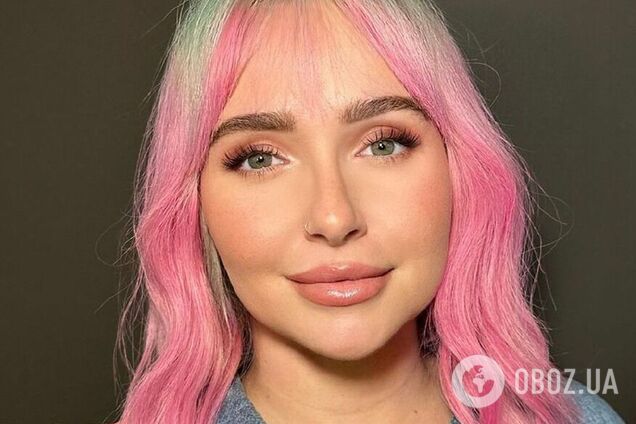 'Что ты сделала со своим безупречным лицом?' Бывшая невеста Кличко смутила сеть кардинальной сменой имиджа