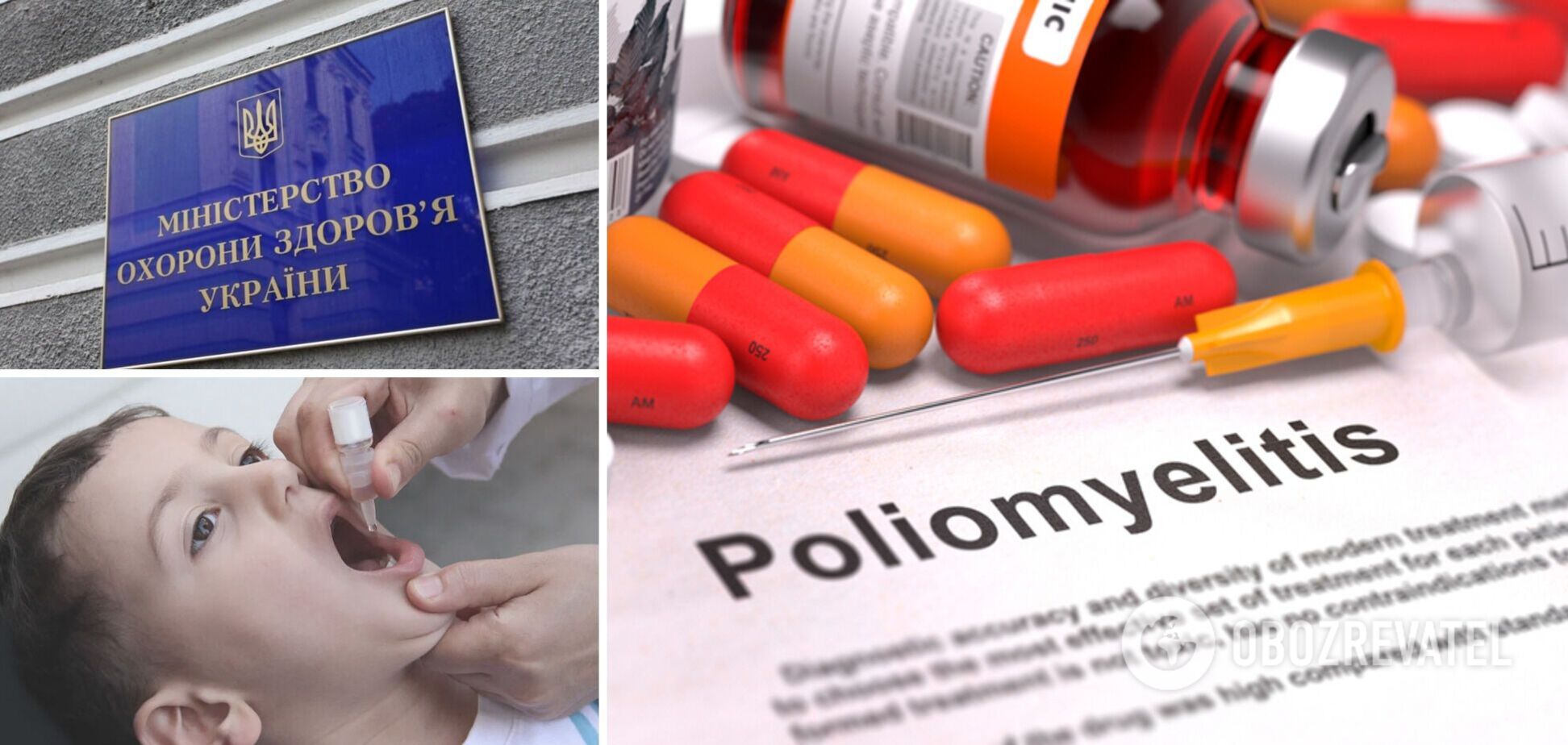 В Україні завершився спалах поліомієліту: у ВООЗ розповіли, як вдалося зупинити поширення вірусу