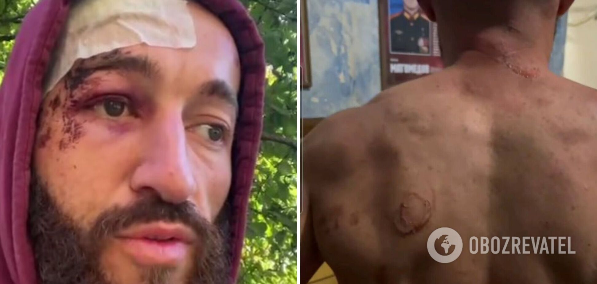 'Я думав, нацисти по той бік': 'мобік' із Північної Осетії поскаржився на знущання солдатів з армії Путіна. Відео