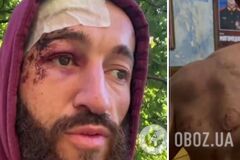 'Я думав, нацисти по той бік': 'мобік' із Північної Осетії поскаржився на знущання солдатів з армії Путіна. Відео