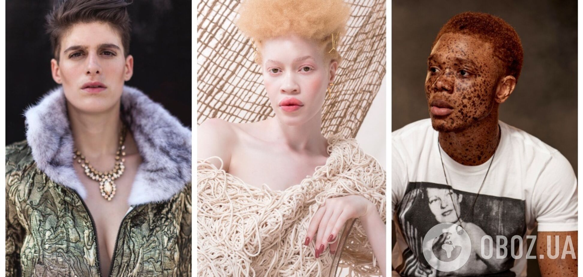 5 моделей, которые бросили вызов стандартам красоты