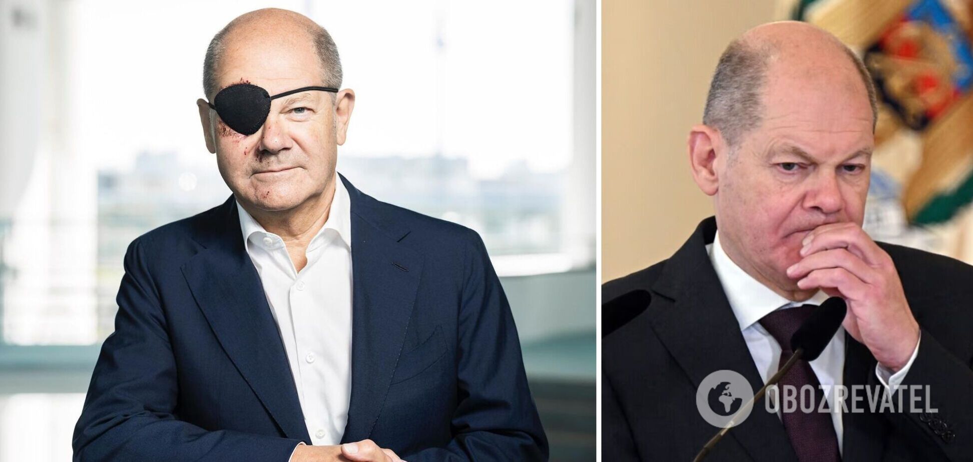 Олаф Шольц показав рани на обличчі