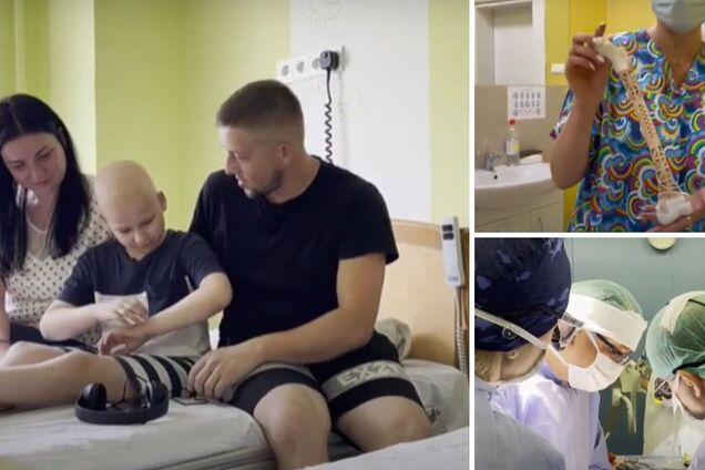 Во Львове больному онкологией мальчику установили напечатанную на 3D-принтере кость, которая будет расти вместе с ним. Видео