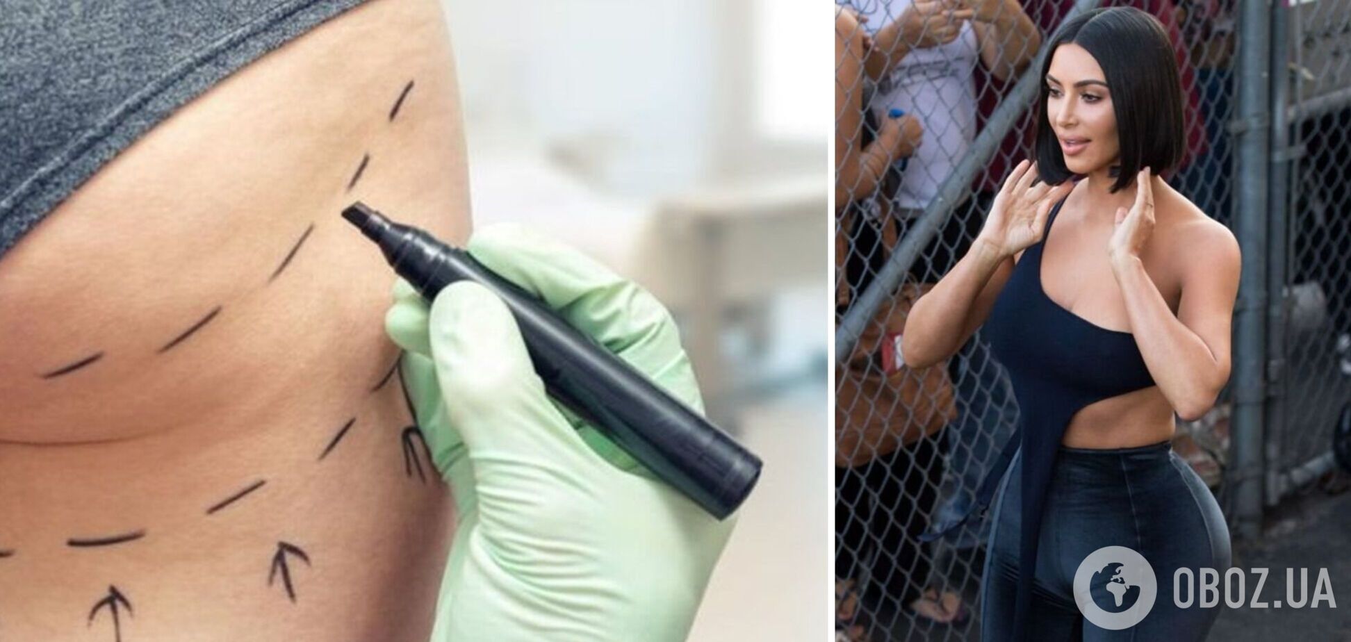 26-річна британка-мама трьох дітей померла в Туреччині після популярної косметологічної процедури. Фото