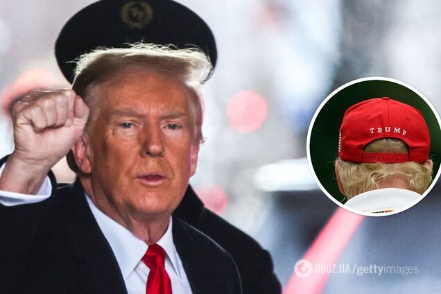 На руке Трампа заметили загадочные красные пятна: фото смутило сеть