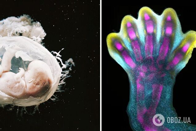 Вчені вперше побачили формування пальців у ембріона: все виявилося не так, як припускали. Відео