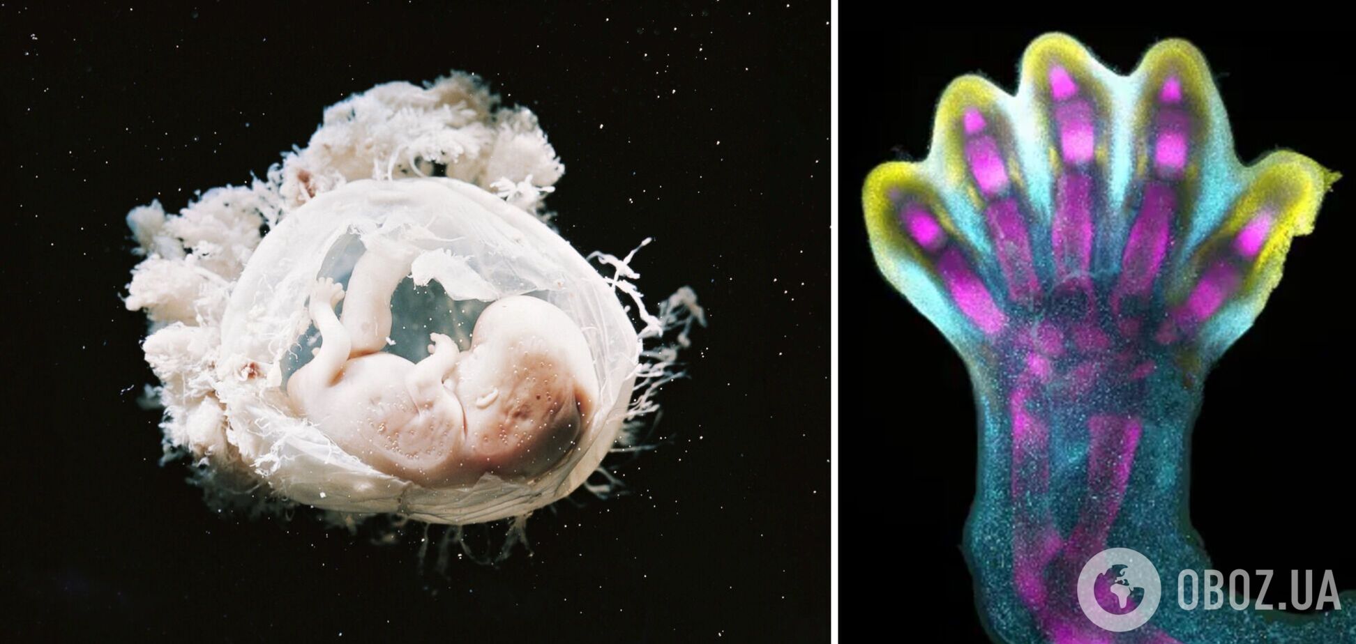 Вчені вперше побачили формування пальців у ембріона: все виявилося не так, як припускали. Відео