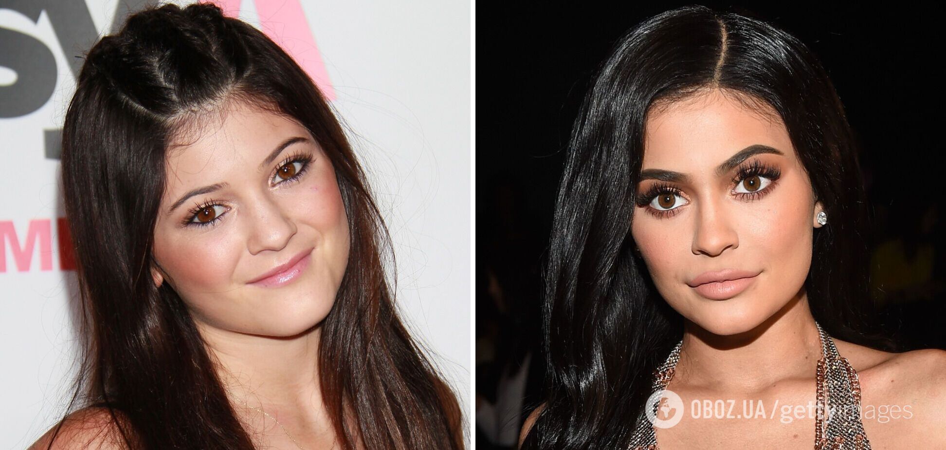 Вовремя не остановились: 5 звезд, которые пластическими операциями изменили себя до неузнаваемости