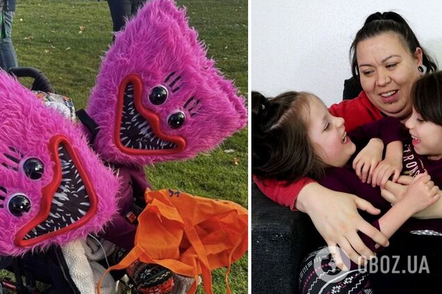 Как выглядят сегодня сиамские близнецы из США Калли и Картер, которых мама скрывала от людей. Фото