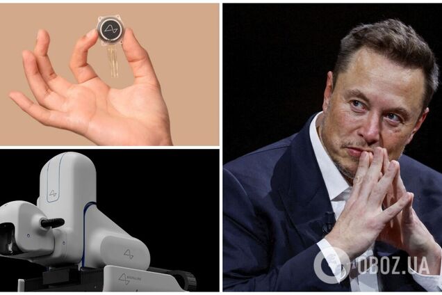 Справжній прорив чи шалений ризик? Як виглядає чип Neuralink, який вперше вживили в мозок людини. Фото