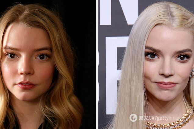 Повезло с хирургом: 5 звезд, которые делали пластические операции, а вы и не заметили