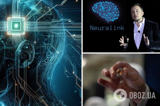 Компанія Маска вперше вживила чип у мозок людини: що це дасть