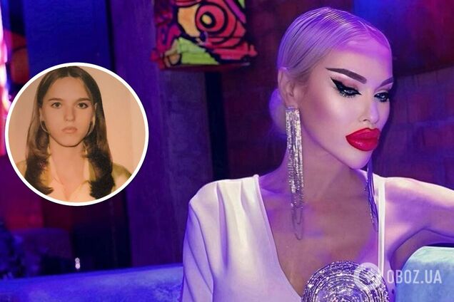 Как выглядела 'королева ДНР' Алина Андриевская в подростковом возрасте без 'утиных губ'. Фото