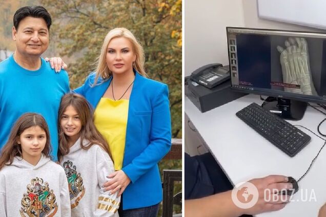 Дочь Камалии второй раз за несколько месяцев попала в больницу с переломом: что известно о ее состоянии