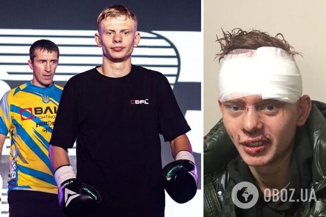 Непобедимый украинский боксер пострадал от ракетного удара по Сумам: кровь заливала лицо чемпиона после попадания баллистики