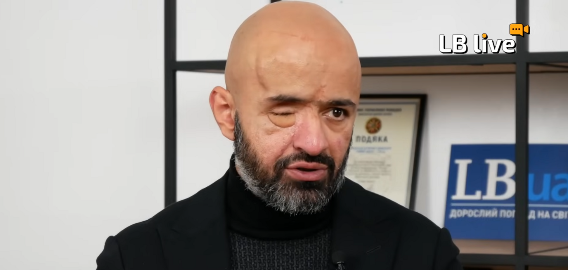 'Если не мобилизовать 160 тыс., мы подписываем капитуляцию': ветеран ВСУ Найем сделал громкое заявление