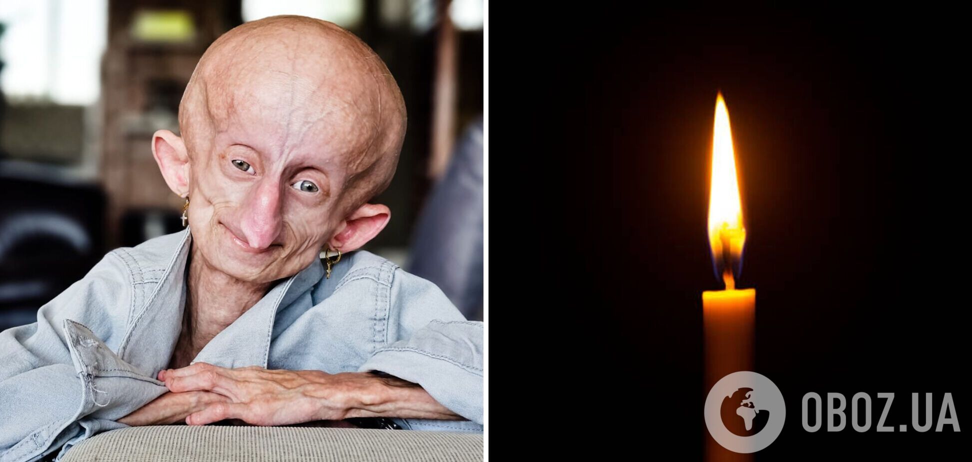 Померла унікальна блогерка, яка старіла у вісім разів швидше, ніж належить: її здолала рідкісна невиліковна хвороба