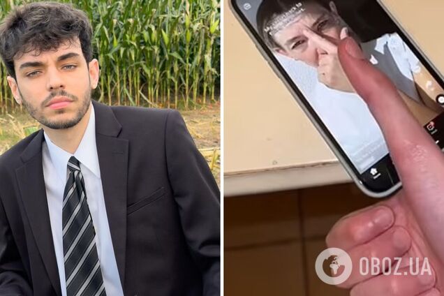 Парень с самым длинным в мире большим пальцем показал, как аномалия мешает ему пользоваться телефоном. Видео