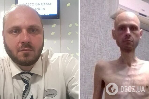 'До конца не мог понять, что на свободе': украинский воин показал страшное фото до и после российского плена