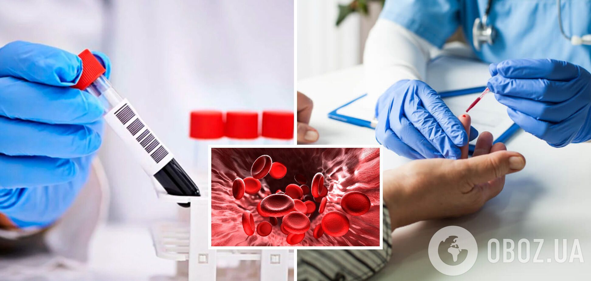 Содержит золото и не всегда красная: шесть удивительных фактов о крови, которые вы могли не знать