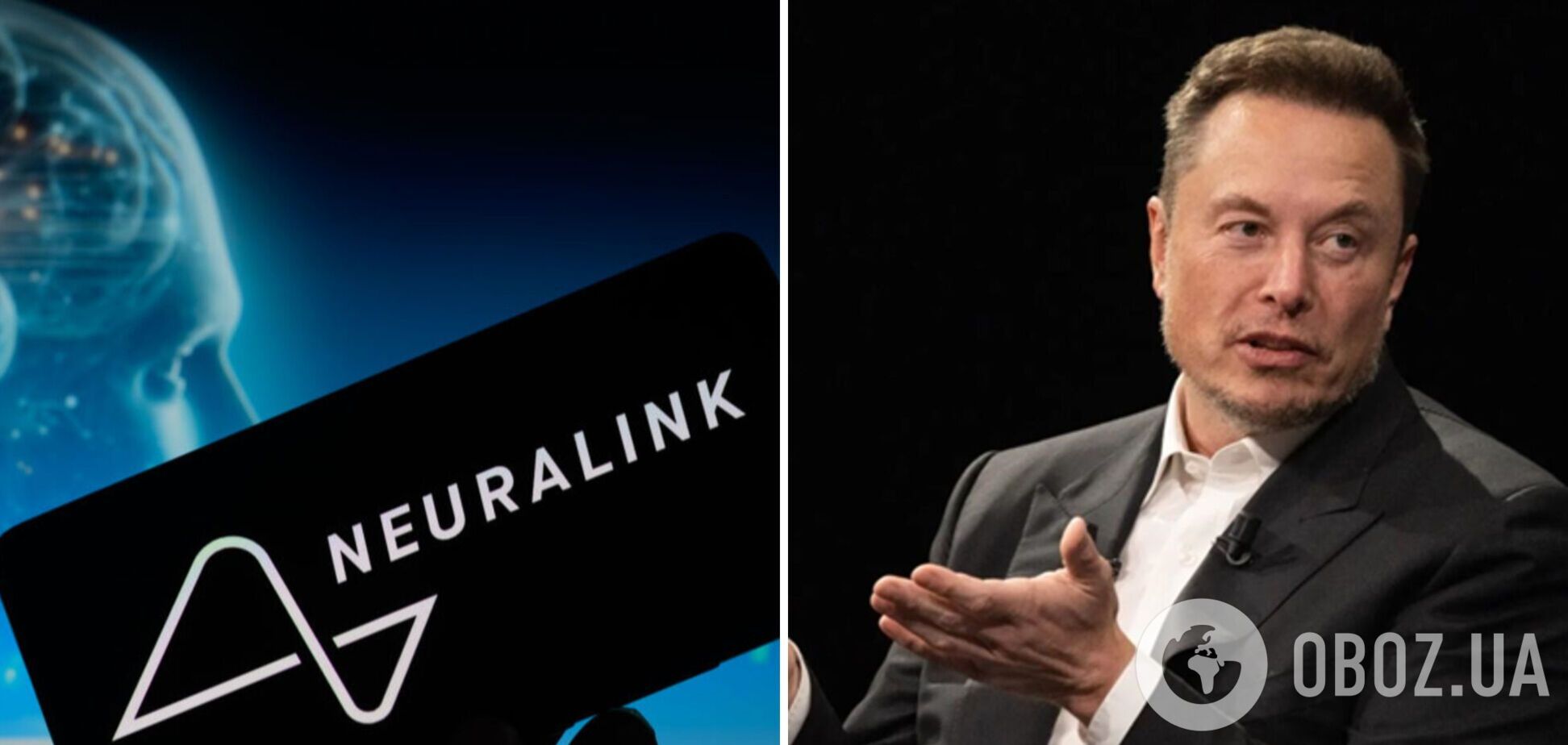 'Здатен керувати комп'ютерною мишею силою думки': Маск розповів про стан пацієнта з імплантованим у мозок чипом Neuralink