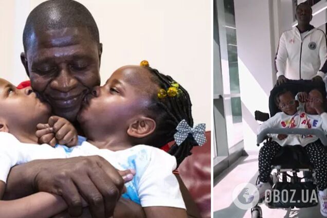 Неразлучные сестры. Как выглядят сейчас 7-летние сиамские близнецы из Сенегала, которым давали всего несколько дней жизни