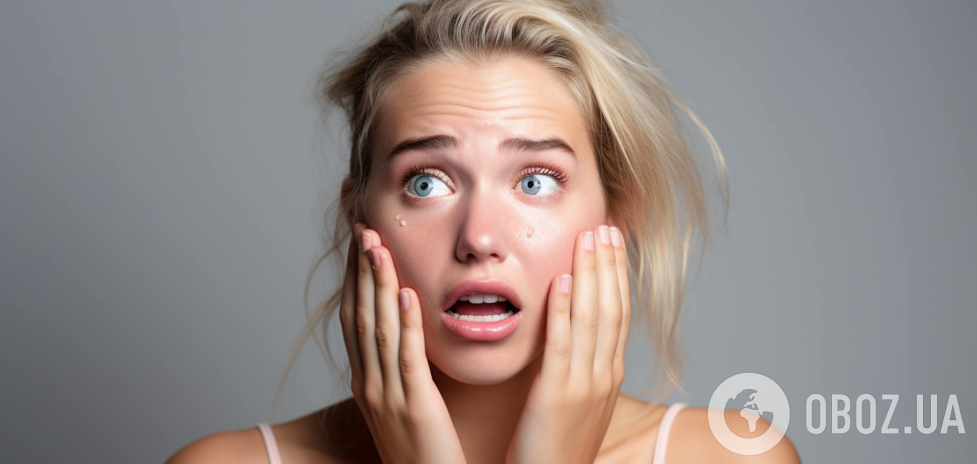 Как замаскировать прыщи без макияжа: действенные средства