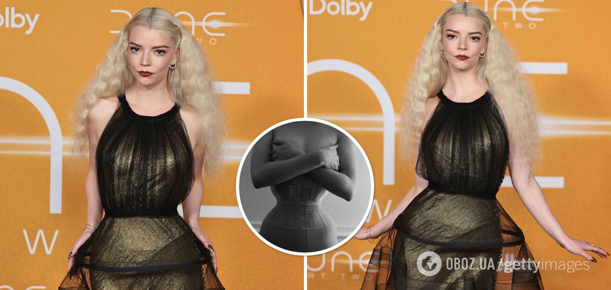 Аню Тейлор-Джой обвинили в пропаганде анорексии: почему фото полуобнаженной актрисы в корсете возмутило сеть