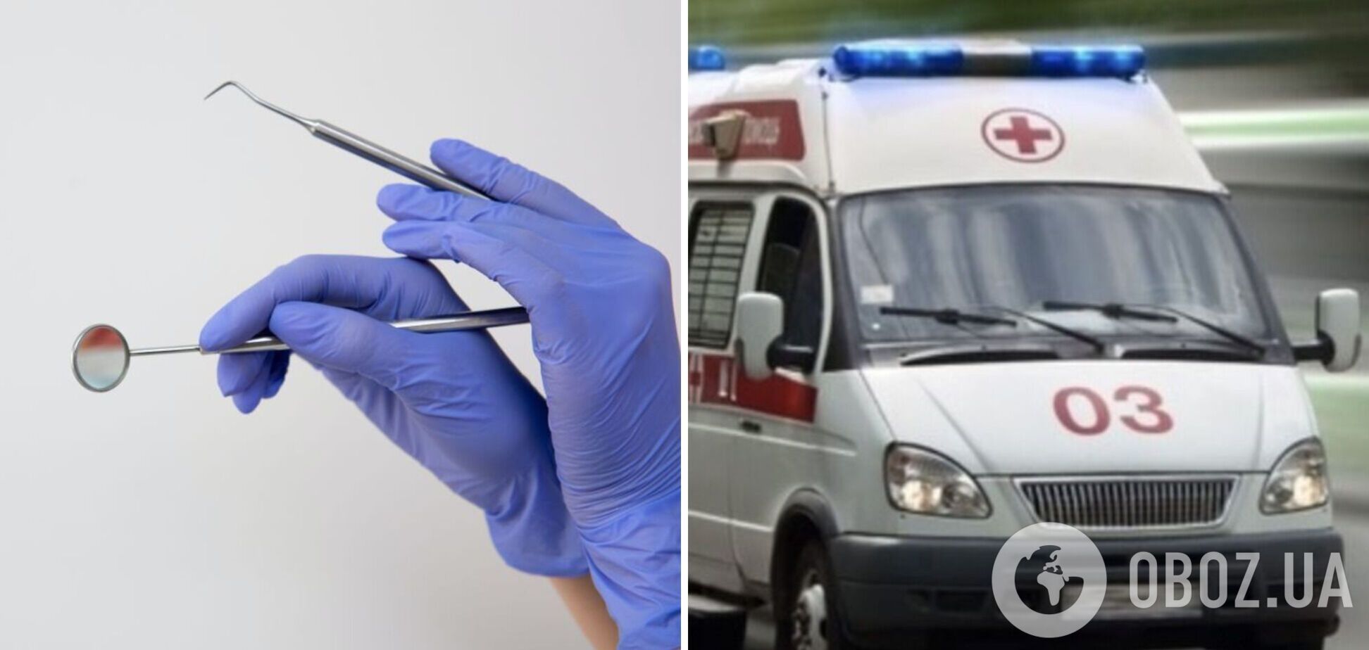 В Черкасской области 5-летний мальчик попал в реанимацию после удаления зубов: подробности полиции